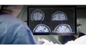 Neuralink trabaja en un robot capaz de colocar implantes cerebrales en humanos