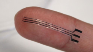 Avance médico: un implante 3D regula la presión arterial mediante impulsos eléctricos
